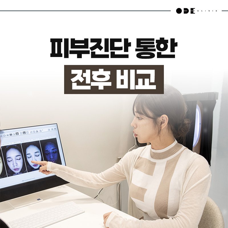 customized lifting treatment Seoul